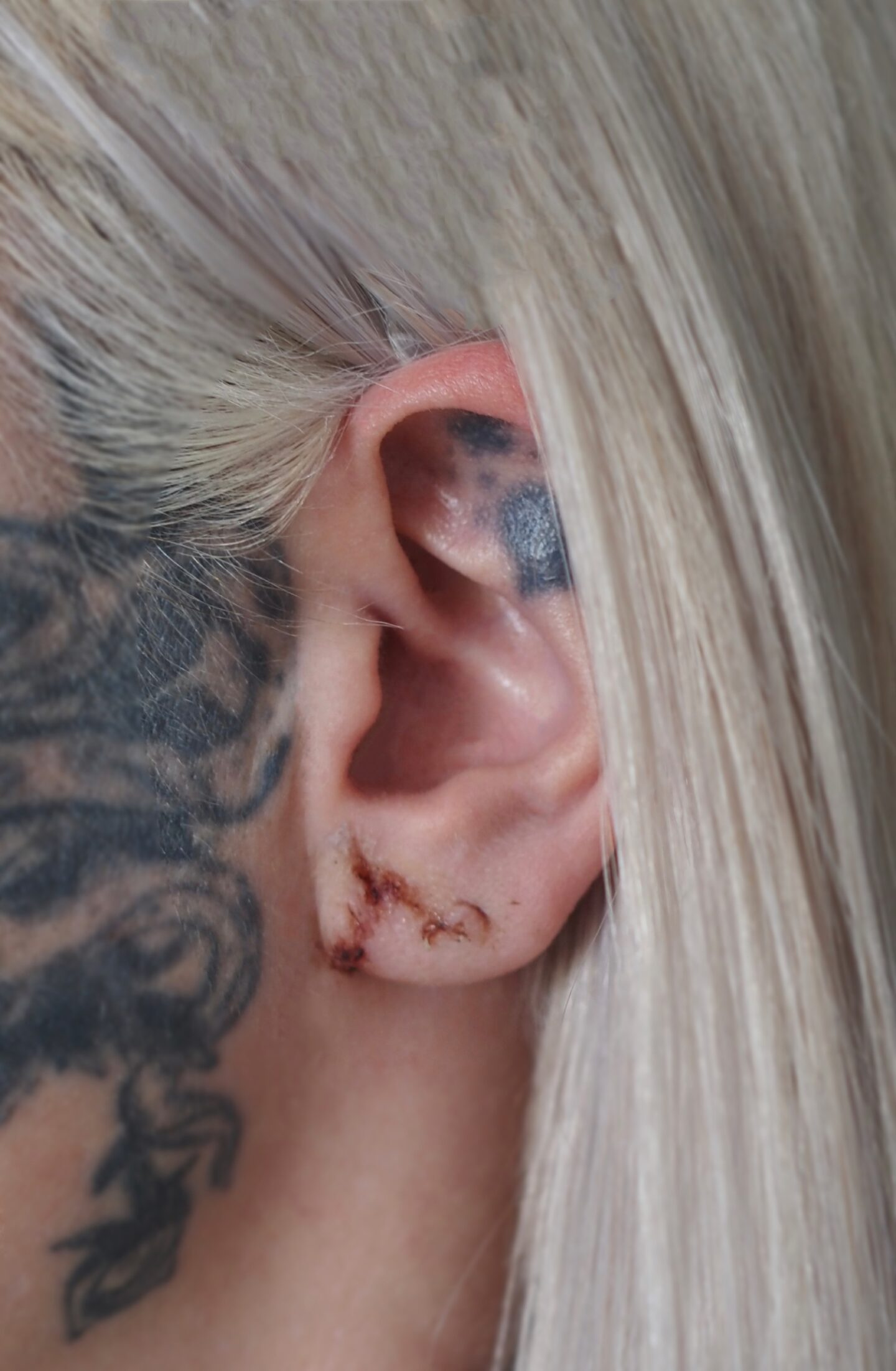 A picture of Eve Sara's ear healing after surgery.